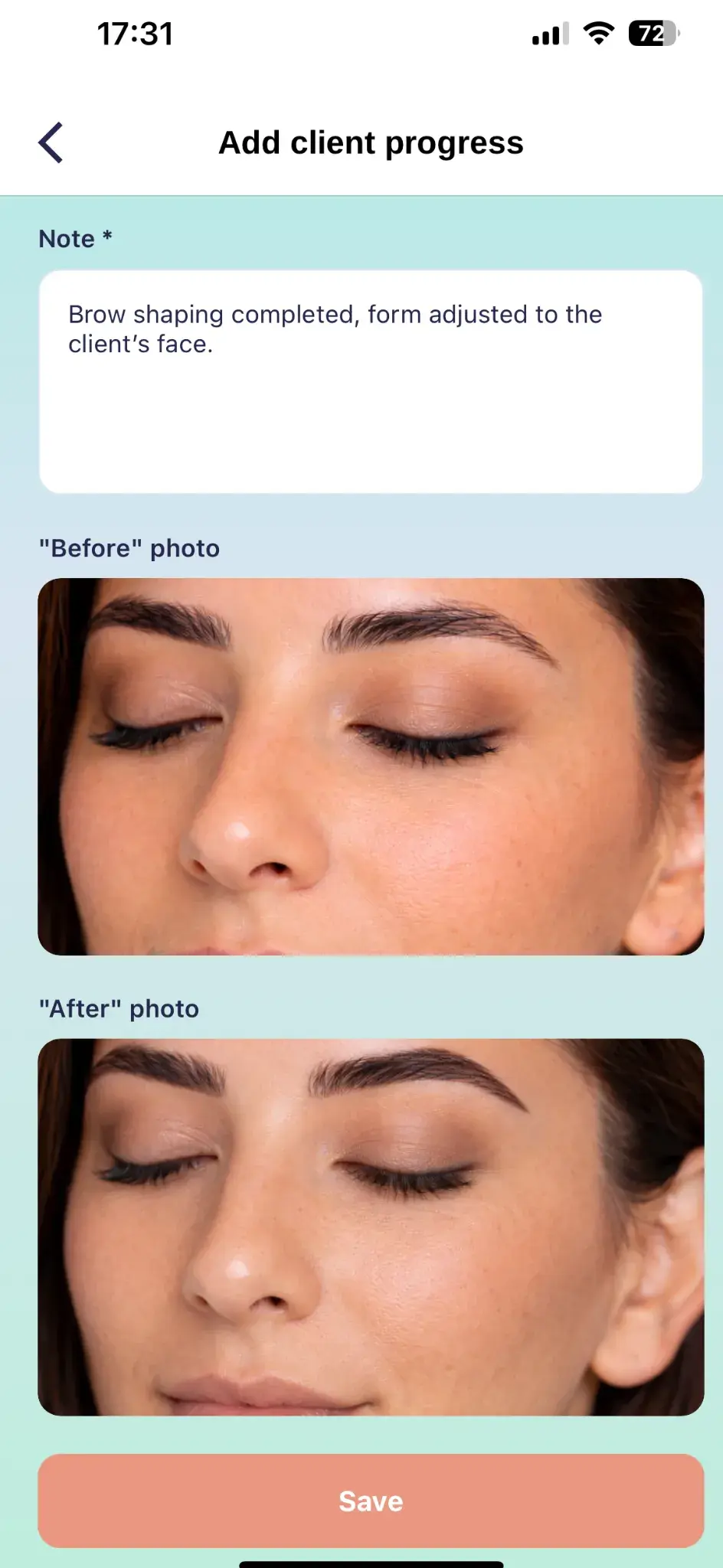 How to add photos