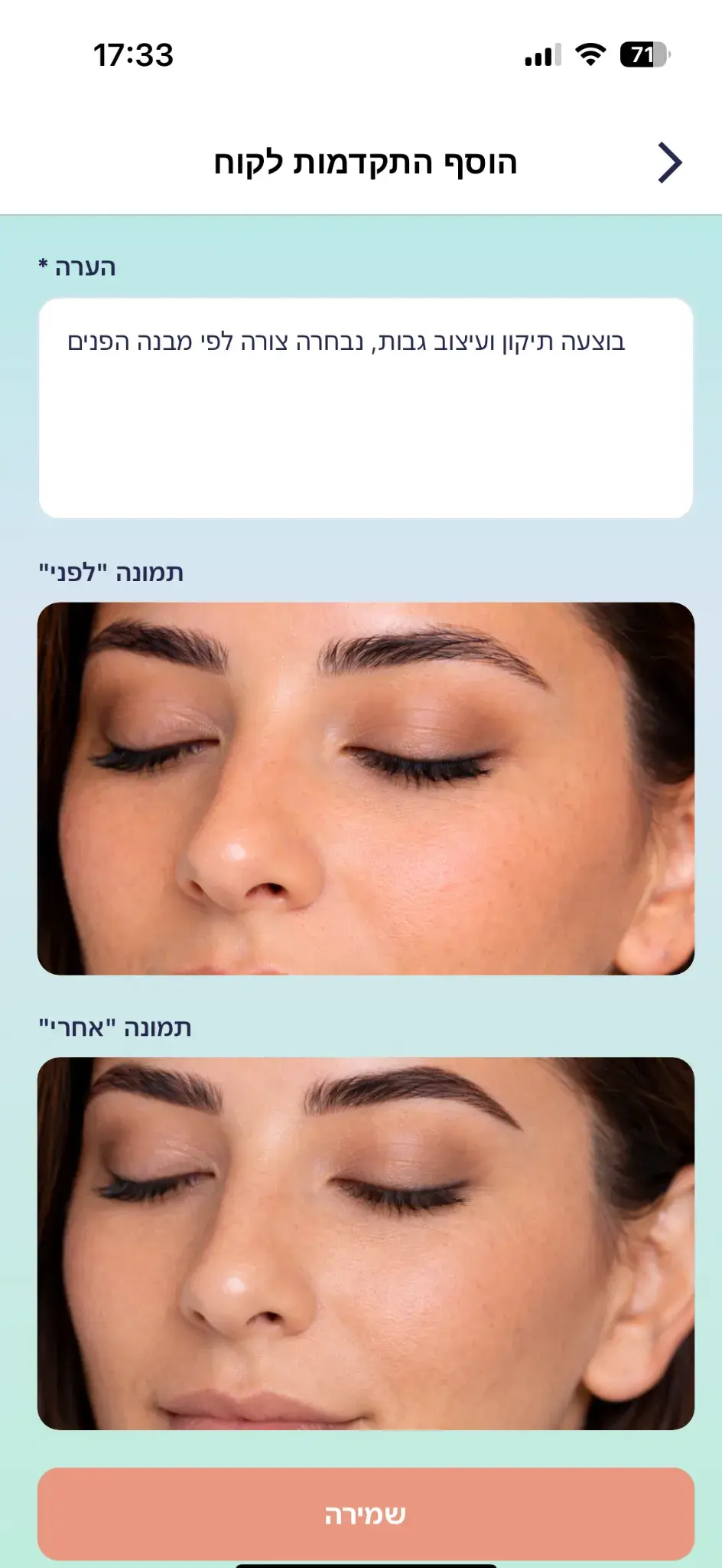 איך מוסיפים תמונות